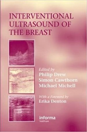 Interventional Ultrasound of the Breast