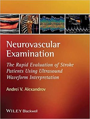 Neurovascular Examination The Rapid Evaluation of Stroke Patients Using Ultrasound Waveform Interpretation