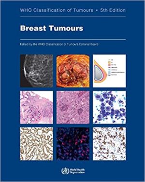 Breast Tumours WHO Classification of Tumours 5th Edition