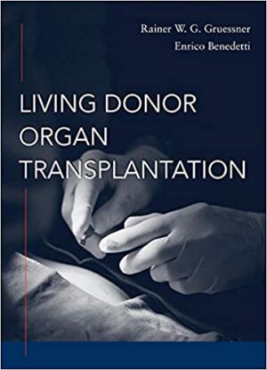 Living Donor Organ Transplantation