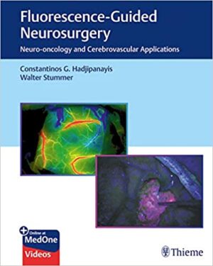 Fluorescence Guided Neurosurgery Neuro Oncology and Cerebrovascular Applications