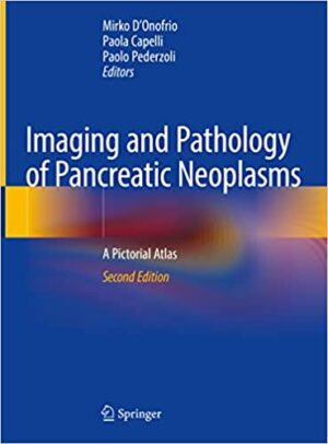 Imaging and Pathology of Pancreatic Neoplasms