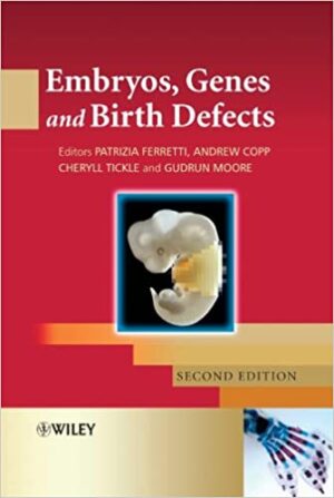 Embryos Genes and Birth Defects 2nd Edition