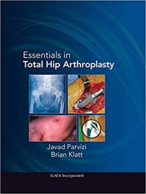 Essentials in Total Hip Arthroplasty