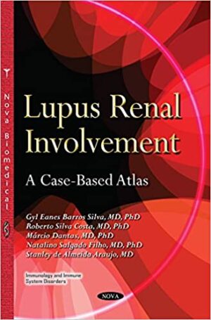 Lupus Renal Involvement A Case Based Atlas