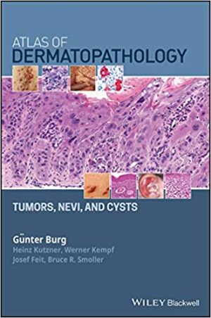 Atlas of Dermatopathology Tumors Nevi and Cysts