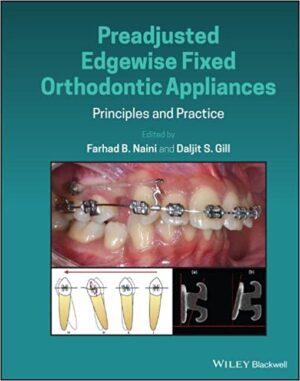 Preadjusted Edgewise Fixed Orthodontic Appliances Principles and Practice