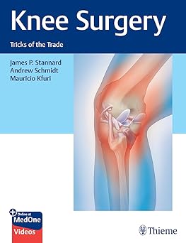 Knee Surgery Tricks of the Trade