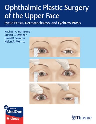 Ophthalmic Plastic Surgery of the Upper Face Eyelid Ptosis Dermatochalasis and Eyebrow Ptosis